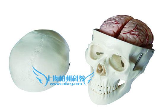 頭骨帶腦動脈模型圖片