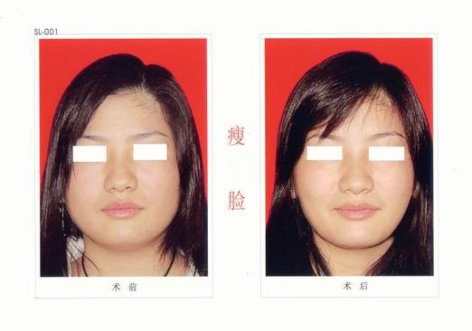 供應(yīng)廠家供應(yīng)*塑形/纖細(xì)*霜