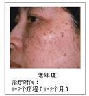 美白淡斑/補(bǔ)水保濕/清爽祛斑霜圖片