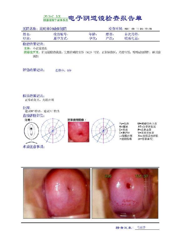 电子阴道镜图文报告胶片图片