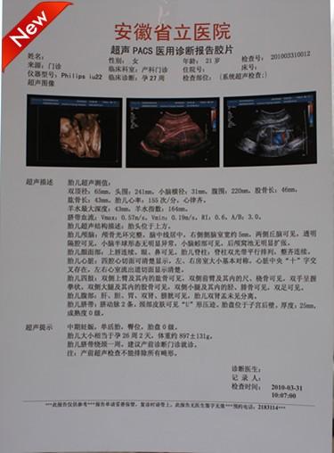 供应惠佰HB激光B超打印胶片