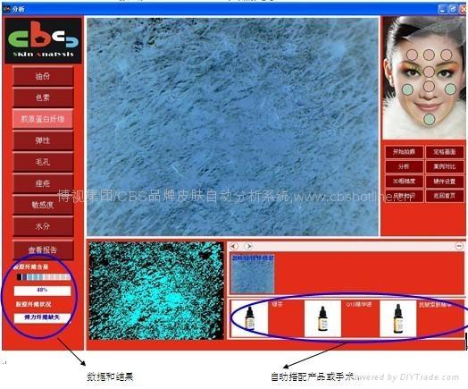 供應(yīng)皮膚分析儀 臺(tái)灣原裝 皮膚檢測系統(tǒng) 皮膚檢測儀