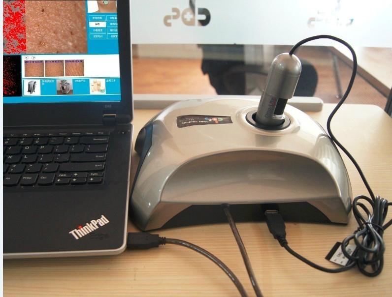 供應cbs毛囊分析儀（植發(fā)、增發(fā)行業(yè)適用）