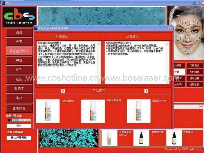 供應cbs毛囊分析儀（植發(fā)、增發(fā)行業(yè)適用）