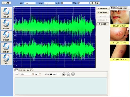 供應(yīng)臺(tái)灣原裝原產(chǎn)電子皮膚鏡