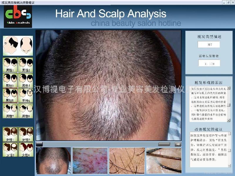 頭皮檢測(cè)儀圖片/頭皮檢測(cè)儀樣板圖 (4)