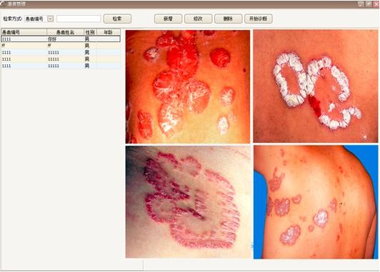 供應(yīng)臺(tái)灣原裝原產(chǎn)電子皮膚鏡