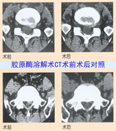 供應(yīng)膠原酶價(jià)格·注射用膠原酶·膠原酶