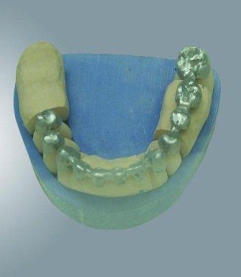 假牙修補(bǔ)、飾品、首飾點(diǎn)焊機(jī)/義齒激光焊品牌