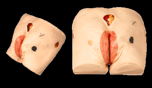 供应高级压疮(褥疮)护理模型型号：HL027