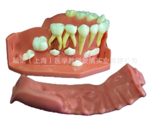 供應(yīng)牙列發(fā)育模型B