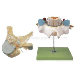 供應胸椎附脊髓和脊神經(jīng)放大模型