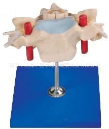 供應(yīng)頸椎附脊髓和脊神經(jīng)放大模型