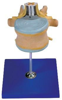 供應(yīng)腰椎附脊髓與馬尾神經(jīng)放大模型