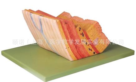 供應(yīng)胃壁放大模型