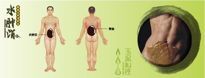 玉泥心经泥灸水肿消泥灸图片