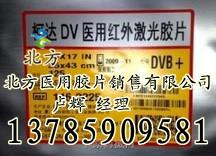 供應(yīng)安康市醫(yī)用膠片總代理