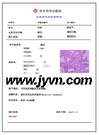 供应液基图文报告打印软件｜液基软件供应商 液基图文报告系统｜液基细胞检查图片