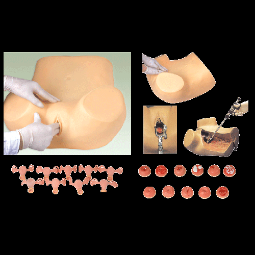 供应高级妇科检查训练模型，妇科检查模型，妇科示教模型