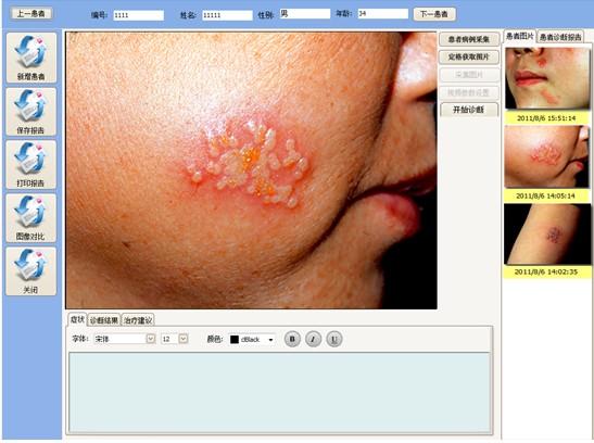 供應(yīng)CBS-901電子皮膚鏡 專業(yè)電子皮膚鏡 皮膚CT機(jī)