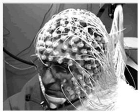 供應(yīng)NeurOne腦事件相關(guān)電位儀EEG/ERP