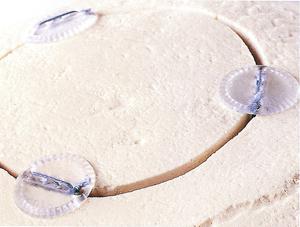 可吸收型顱骨固定系統(tǒng)圖片