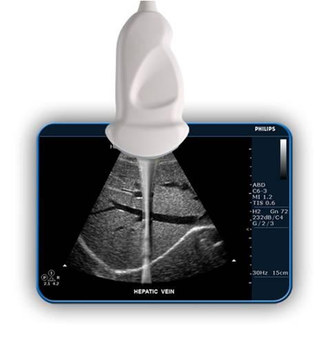 供应飞利浦彩超HD3小器官探头L12-3图片