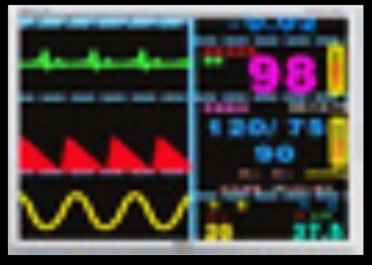 天馬800600LCD液晶屏圖片