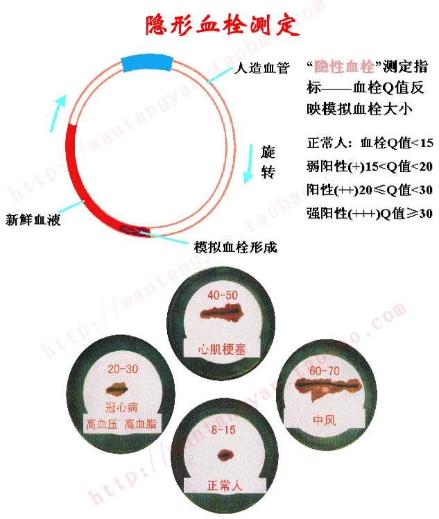 供應(yīng)溶栓*血栓檢測(cè)儀