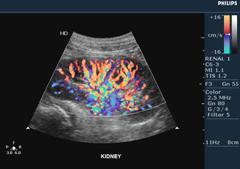 飛利浦圖片/飛利浦樣板圖 (4)