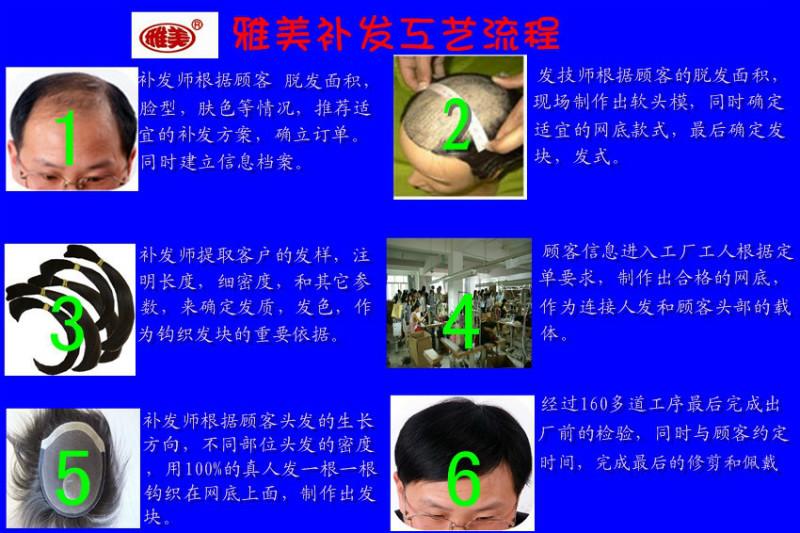 供應(yīng)滄州海興專業(yè)定制無痕隱形假發(fā)、海興專業(yè)補(bǔ)發(fā)、海興*假發(fā)、海興真人發(fā)假發(fā)、海興手鉤假發(fā)、海興隱形補(bǔ)發(fā)