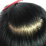 滄州吳橋雅美增發(fā)，滄州雅美植發(fā)補(bǔ)發(fā)，滄州雅美假發(fā) 滄州吳橋補(bǔ)發(fā)