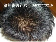 供應(yīng)故城縣隱形假發(fā)，故城隱形織發(fā)，故城隱形補(bǔ)發(fā)，故城無(wú)痕假發(fā)