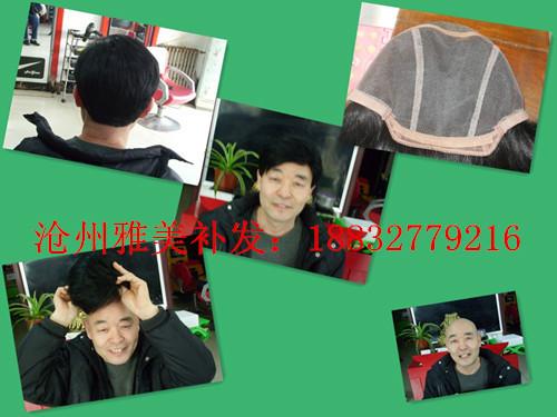供應(yīng)泊頭市無痕假發(fā)，泊頭專業(yè)無痕補(bǔ)發(fā)，泊頭隱形織發(fā)，泊頭隱形假發(fā)