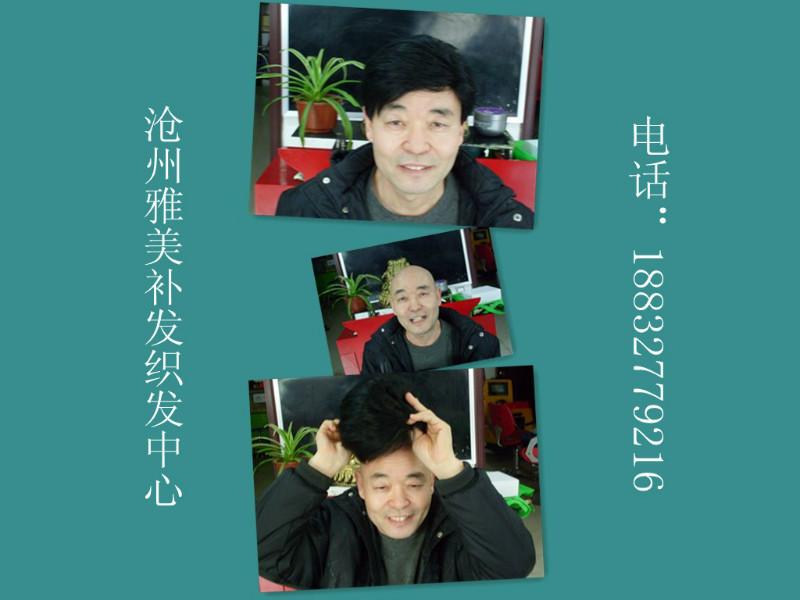 塘沽無痕假發(fā)，塘沽專業(yè)補發(fā)，塘沽隱形織發(fā)，塘沽隱形補發(fā)，男女補發(fā) 塘沽補發(fā)