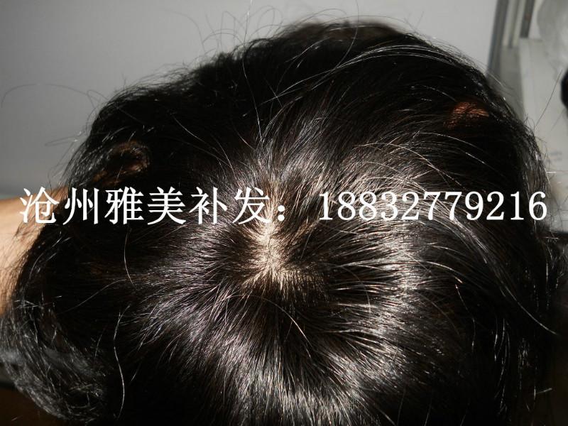 供應(yīng)南皮補(bǔ)發(fā)店 ，南皮縣專業(yè)假發(fā)店，南皮縣脫發(fā)，南皮假發(fā)批發(fā)