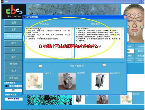 CBS皮膚檢測分析系統(tǒng)