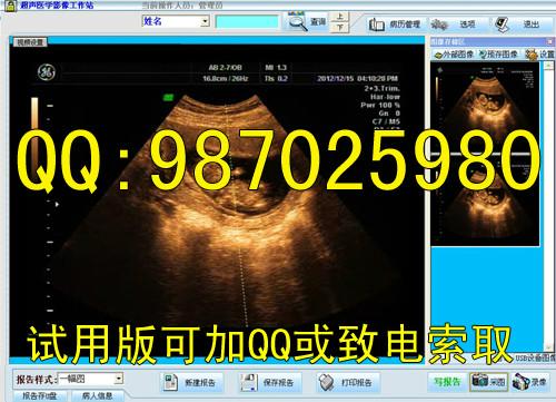 碎石b超软件超声碎石工作站软件图片