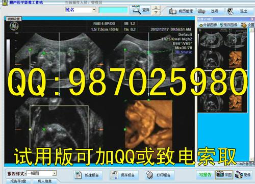 供应B超工作站软件B超软件彩超通用版软件2013版彩超软件