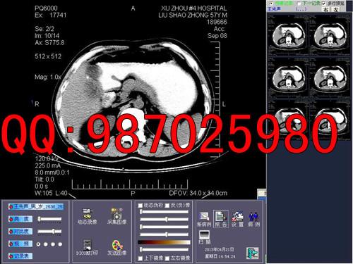 供应CT工作站CT软件CT模拟转数字软件CT模拟软件图片