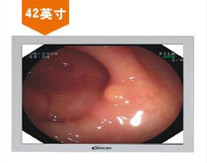 42寸內(nèi)窺手術(shù)醫(yī)用顯示器圖片