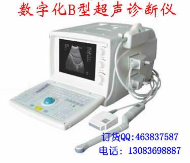 供应便携式B超B型超声诊断仪