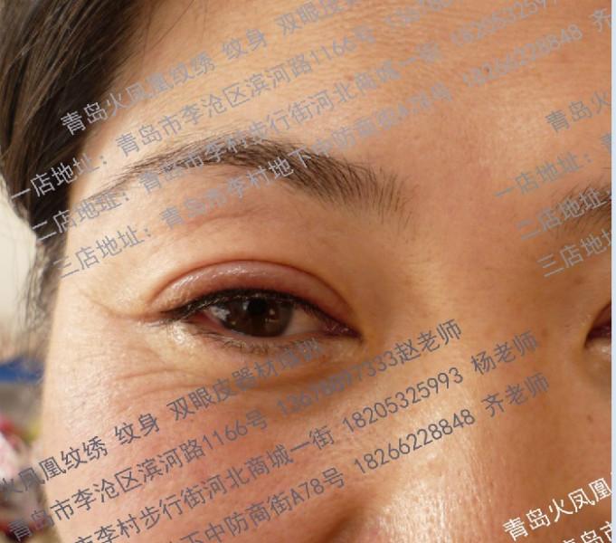 雙眼皮圖片/雙眼皮樣板圖 (2)